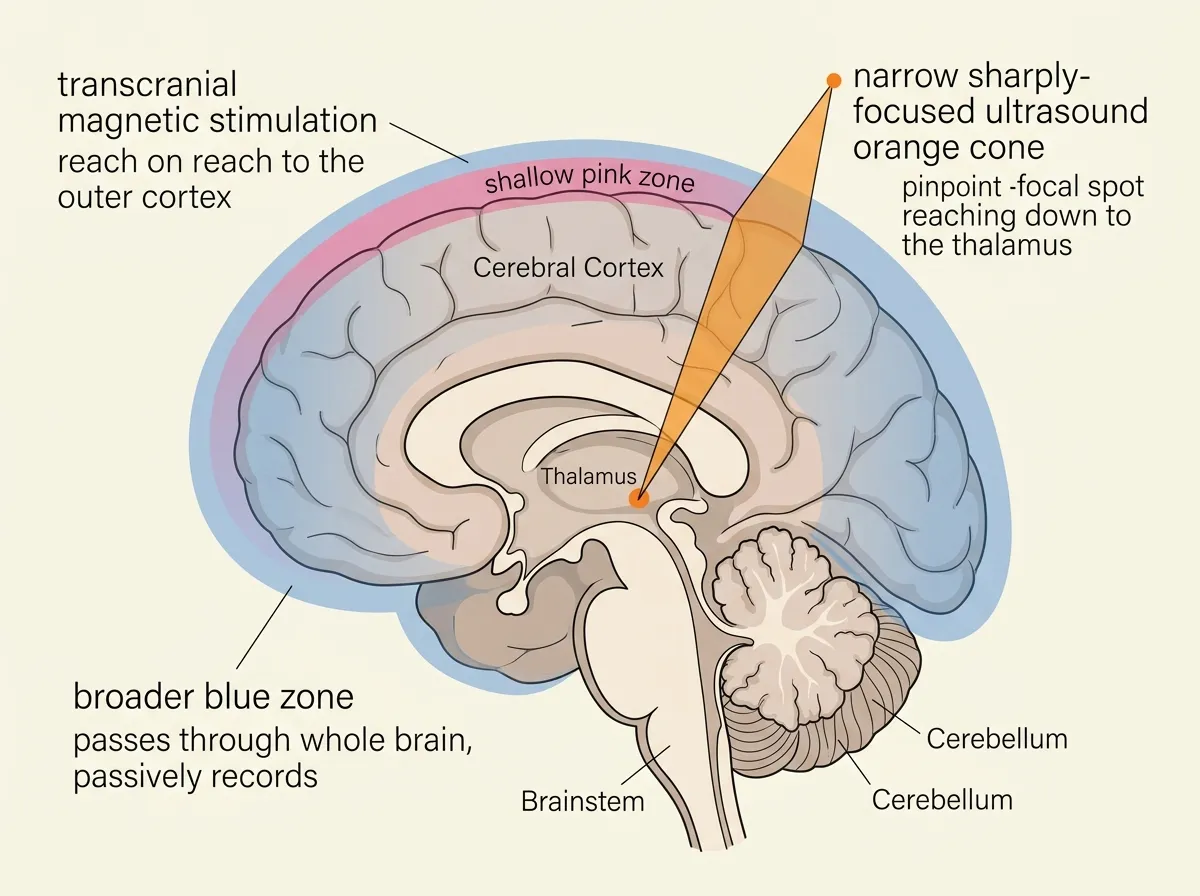 Diagram comparing the reach and resolution of fMRI TMS and focused ultrasound in the human brain